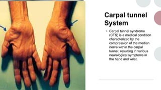 Carpal tunnel
System
• Carpal tunnel syndrome
(CTS) is a medical condition
characterized by the
compression of the median
nerve within the carpal
tunnel, resulting in various
neurological symptoms in
the hand and wrist.
 