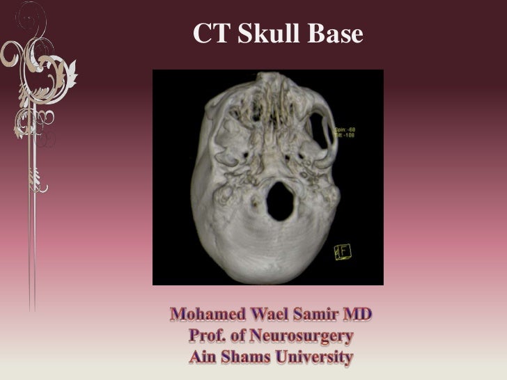 ct skull base