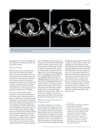 Patient exceeding the field of measurement without correction (Fig. 5A). Same slice as in Fig. 5A reconstructed with 
HD FoV reconstruction (Fig. 5B). 
Science 
SOMATOM Sessions | December 2013 | www.siemens.com/SOMATOM-Sessions 71 
especially as the volume coverage can 
be achieved more effectively with fast 
acquisition speeds. 
Metal artifacts 
Metal artifacts are a combination of 
almost all of the effects described 
above. The particular effect that may 
occur depends on the alloy, shape, size, 
and position. Generally, the transition 
from tissue to metal is very abrupt 
compared with the size of the detector 
channels. So partial volume effects or 
sampling errors contribute to metal-induced 
artifacts, which appear as thin 
streaks emanating from the edges. 
As the size of the metallic object 
increases, so does the attenuation of 
the X-rays. Beam hardening becomes 
relevant. Moreover, the absolute signal 
measured in certain detector elements 
behind the implant becomes so low that 
the reading is no longer reliable due 
to the high level of noise. Both effects 
may completely destroy the image con-tent 
for rays passing through a large 
amount of metal. Using a higher voltage 
reduces beam hardening as well as a 
lack of detector signal due to smaller 
attenuation at higher photon energies. 
Selecting higher mAs, on the other 
hand, does not improve the situation 
significantly but will increase radiation 
dose. Intelligent automatic exposure 
controls such as Siemens CARE Dose4D 
exclude metallic objects when calcu-lating 
optimal mAs settings, because 
no benefit is observed with regard 
to image quality compared with the 
higher dose. Dual Energy scanning – 
which is available on the SOMATOM 
Force, SOMATOM Definition Flash, 
the SOMATOM Definition Edge, all 
SOMATOM Definition AS systems, and 
now also for SOMATOM Perspective 
scanner family – can also be used to 
reduce metal artifacts efficiently by 
calculating monoenergetic images – 
another form of advanced beam-hardening 
correction (Fig. 4A/B). Fur-thermore, 
all Siemens CT scanners 
apply advanced filters to the raw data 
to reduce disturbing noise structures. 
Objects outside the field of 
measurement 
The relation between CT raw data 
and reconstructed images causes arti-facts 
if objects are inside the gantry, 
but exceed the field of measurement. 
Patients larger than the maximal scan-ning 
field or arms lateral to the body 
likewise produce artificial hyperdense 
edges (Fig. 5A) if not accounted for in 
the reconstruction. The latest Siemens 
scanners automatically apply advanced 
5 
extrapolation-type algorithms (HD FoV) 
in order to reduce those artifacts con-siderably 
(Fig. 5B). Moreover, they 
offer special reconstruction techniques 
to display objects located outside the 
field of measurement with high accu-racy. 
This is especially important in 
radiation therapy planning where treat-ment 
plans are based on the correct 
measurement of CT numbers and 
parts of the patient are frequently 
located outside the field of measure-ment 
due to fixation devices. There 
are diverse origins of artifacts in CT 
imaging. Solutions need to be equally 
diverse to intelligently deliver diag-nostic 
results. 
5A 5B 
References 
[1] Kalender WA: Computed Tomography, 
Publicis MCD: 22ff (2000) 
[2] Herman GT, Trivedi SS. A Comparative 
Study of Two Postreconstruction Beam 
Hardening Correction Methods, IEEE 
Transactions on Medical Imaging. 
1983 Sep; Vol MI-2; No 3: 128-135 
[3] Flohr T, Stierstorfer K, Raupach R, 
Ulzheimer S, Bruder H. Performance 
evaluation of a 64-slice CT system 
with z-flying focal spot. Rofo. 2004 
Dec;176(12):1803-10. 
 