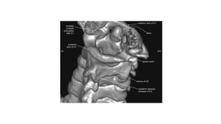 The skull base has been cut away nearly completely in this
CT model, allowing the ring of C1 and its relationship to the
dens of C2 to be seen in detail.
C1 and C2 view of the normal cervical spine
 