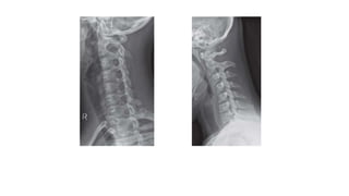 Right oblique view Dynamic flexion view
 