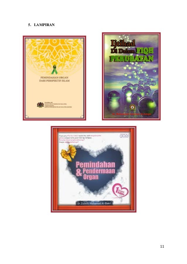 PDF- Ctu 221- Hukum Pendermaan dan Pemindahan Organ