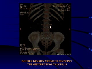CT UROGRAPHY FROM SEEING TO UNDERSTANDING | PPT