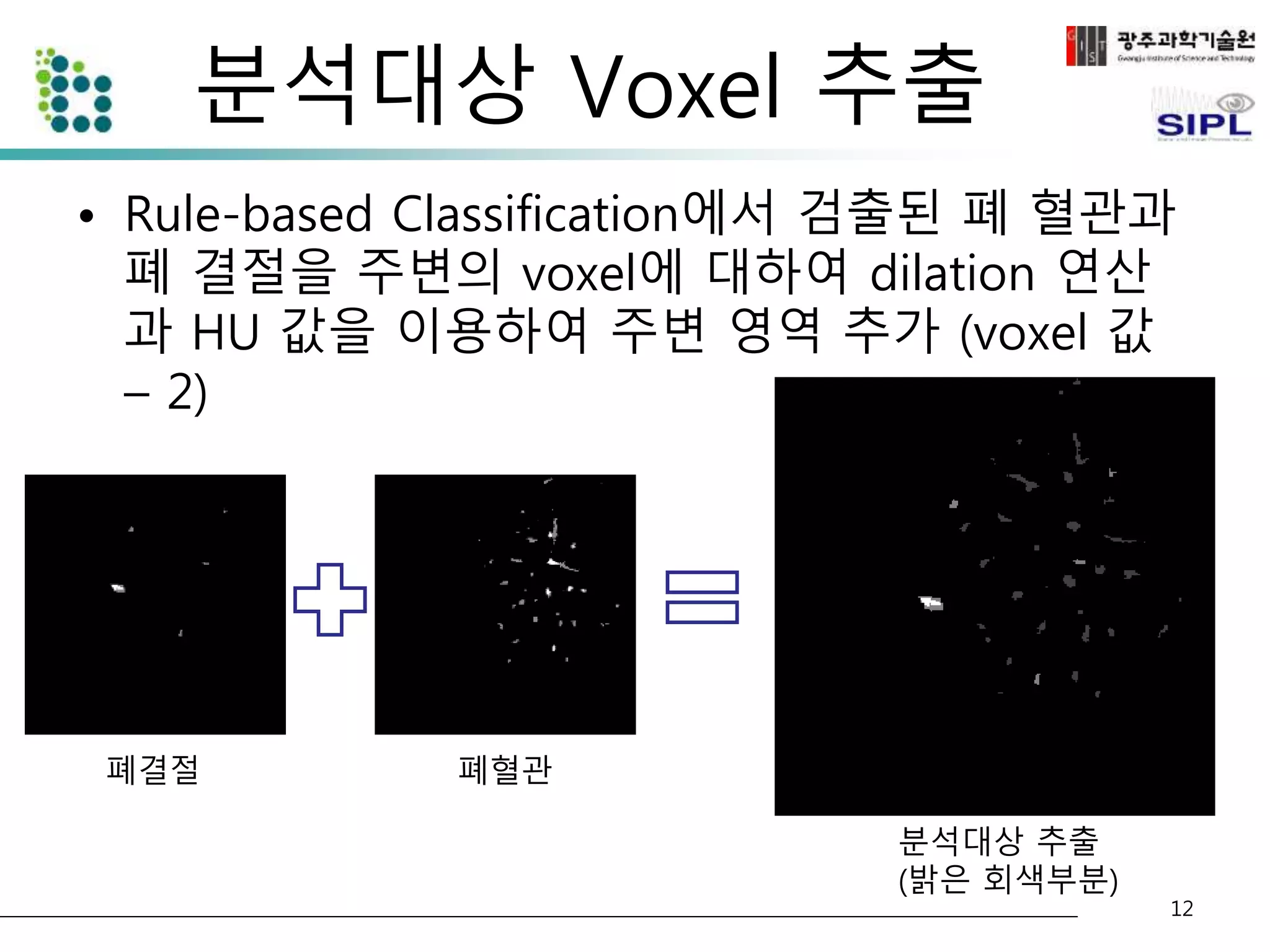 분석대상 Voxel 추출 
• Rule-based Classification에서 검출된 폐 혈관과 
폐 결절을 주변의 voxel에 대하여 dilation 연산 
과 HU 값을 이용하여 주변 영역 추가 (voxel 값 
– 2) 
12 
폐결절 폐혈관 
분석대상 추출 
(밝은 회색부분) 
 