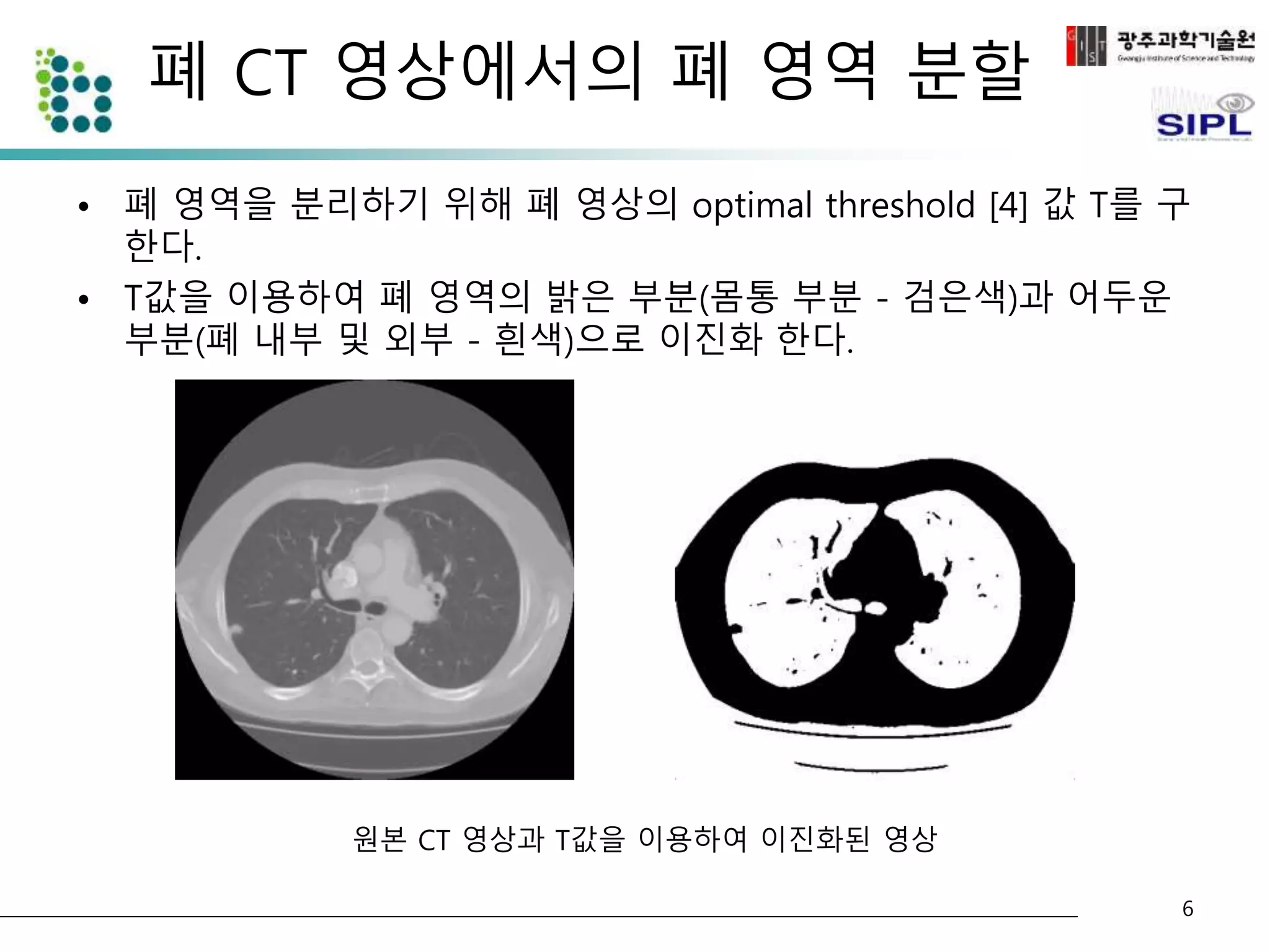 폐 CT 영상에서의 폐 영역 분할 
• 폐 영역을 분리하기 위해 폐 영상의 optimal threshold [4] 값 T를 구 
한다. 
• T값을 이용하여 폐 영역의 밝은 부분(몸통 부분 - 검은색)과 어두운 
부분(폐 내부 및 외부 - 흰색)으로 이진화 한다. 
6 
원본 CT 영상과 T값을 이용하여 이진화된 영상 
 