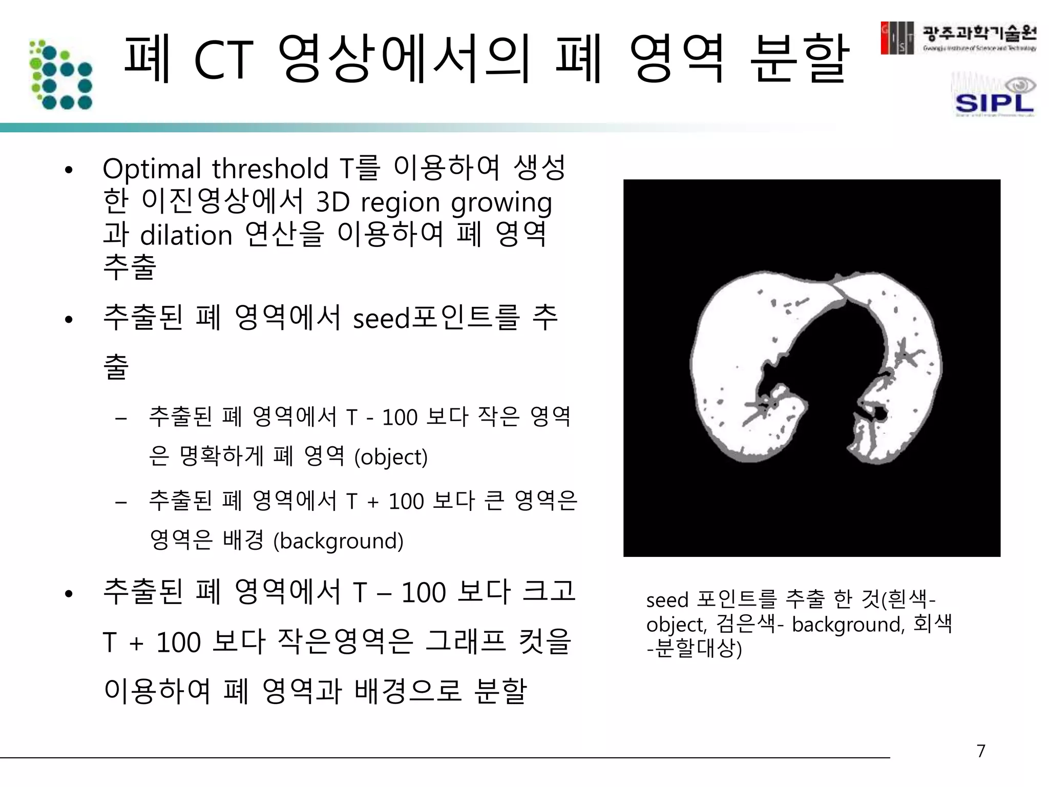 폐 CT 영상에서의 폐 영역 분할 
seed 포인트를 추출 한 것(흰색- 
object, 검은색- background, 회색 
-분할대상) 
• Optimal threshold T를 이용하여 생성 
한 이진영상에서 3D region growing 
과 dilation 연산을 이용하여 폐 영역 
추출 
• 추출된 폐 영역에서 seed포인트를 추 
출 
– 추출된 폐 영역에서 T - 100 보다 작은 영역 
은 명확하게 폐 영역 (object) 
– 추출된 폐 영역에서 T + 100 보다 큰 영역은 
영역은 배경 (background) 
• 추출된 폐 영역에서 T – 100 보다 크고 
T + 100 보다 작은영역은 그래프 컷을 
이용하여 폐 영역과 배경으로 분할 
7 
 