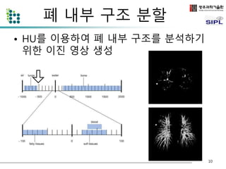 폐 내부 구조 분할 
• HU를 이용하여 폐 내부 구조를 분석하기 
위한 이진 영상 생성 
10 
 