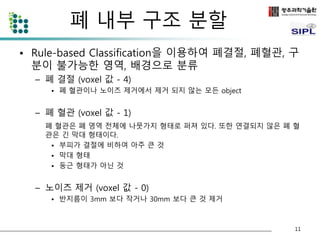 폐 내부 구조 분할 
• Rule-based Classification을 이용하여 폐결절, 폐혈관, 구 
분이 불가능한 영역, 배경으로 분류 
– 폐 결절 (voxel 값 - 4) 
• 폐 혈관이나 노이즈 제거에서 제거 되지 않는 모든 object 
– 폐 혈관 (voxel 값 - 1) 
폐 혈관은 폐 영역 전체에 나뭇가지 형태로 퍼져 있다. 또한 연결되지 않은 폐 혈 
관은 긴 막대 형태이다. 
• 부피가 결절에 비하여 아주 큰 것 
• 막대 형태 
• 둥근 형태가 아닌 것 
– 노이즈 제거 (voxel 값 - 0) 
• 반지름이 3mm 보다 작거나 30mm 보다 큰 것 제거 
11 
 