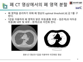 폐 CT 영상에서의 폐 영역 분할 
• 폐 영역을 분리하기 위해 폐 영상의 optimal threshold [4] 값 T를 구 
한다. 
• T값을 이용하여 폐 영역의 밝은 부분(몸통 부분 - 검은색)과 어두운 
부분(폐 내부 및 외부 - 흰색)으로 이진화 한다. 
6 
원본 CT 영상과 T값을 이용하여 이진화된 영상 
 