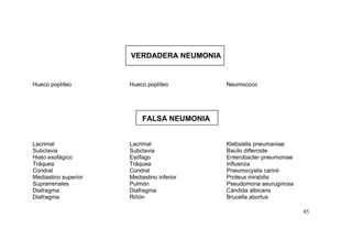 VERDADERA NEUMONIA
Hueco poplíteo Hueco poplíteo Neumococo
FALSA NEUMONIA
Lacrimal Lacrimal Klebsiella pneumaniae
Subclavia Subclavia Bacilo difteroide
Hiato esofágico Esófago Enterobacter pneumoniae
Tráquea Tráquea Influenza
Condral Condral Pneumocystis carinii
Mediastino superior
Suprarrenales
Mediastino inferior
Pulmón
Proteus mirabilis
Pseudomona aeuruginosa
Diafragma Diafragma Cándida albicans
Diafragma Riñón Brucella abortus
85
 