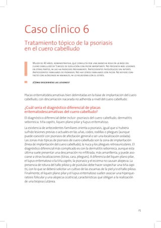 25
Caso clínico 6
Tratamiento tópico de la psoriasis
en el cuero cabelludo
Mujer de 40 años, administrativa, que consulta por una mancha roja en la base del
cuero cabelludo de 5 meses de evolución con picor importante. No presenta más lesiones
en otras partes, ni las ha padecido previamente. Antecedentes patológicos sin interés.
Antecedentes familiares de psoriasis. No hay otros familiares con picor. No refiere con-
tacto con alérgenos ni animales, ni lo relaciona con el estrés.
¿Cómo describirías las lesiones?
Placas eritematodescamativas bien delimitadas en la base de implantación del cuero
cabelludo, con descamación nacarada no adherida a nivel del cuero cabelludo.
¿Cuál sería el diagnóstico diferencial de placas
eritematodescamativas del cuero cabelludo?
El diagnóstico diferencial debe incluir: psoriasis del cuero cabelludo, dermatitis
seborreica, tiña capitis, liquen plano pilar y lupus eritematoso.
La existencia de antecedentes familiares orienta a psoriasis, igual que si hubiera
sufrido lesiones previas o actuales en las uñas, codos, rodillas o pliegues (aunque
puede coexistir con psoriasis de afectación general o ser una localización aislada).
Las zonas más típicas de psoriasis de cuero cabelludo son la zona de implantación
(línea de implantación del cuero cabelludo), la nuca y los pliegues retroauriculares. El
diagnóstico diferencial más complicado es con la dermatitis seborreica, aunque esta
última suele presentar una descamación no infiltrada, más amarillenta, y puede aso-
ciarse a otras localizaciones (tórax, cara, pliegues). A diferencia del liquen plano pilar,
el lupus eritematoso o la tiña capitis, la psoriasis y el eccema no causan alopecia. La
presencia de rotura del tallo piloso y de pústulas debe hacer sospechar una tiña capi-
tis, con lo que se deberá solicitar un cultivo de las escamas de la piel y/o el tallo piloso.
Finalmente, el liquen plano pilar y el lupus eritematoso suelen asociar una hiperque-
ratosis folicular y una alopecia cicatricial, características que obligan a la realización
de una biopsia cutánea.
 