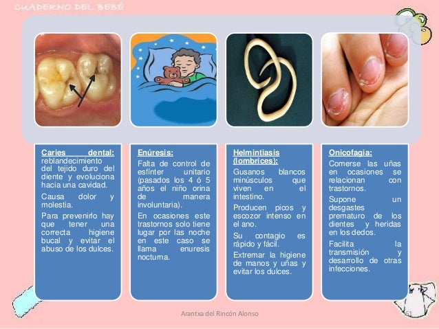 Pueden vivir cuanto los parásitos en el organismo de la persona