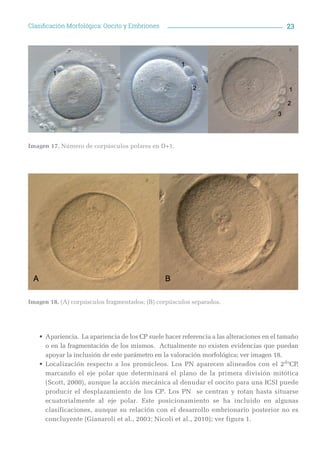 23Clasificación Morfológica: Oocito y Embriones
•	Apariencia. La apariencia de los CP suele hacer referencia a las alterac...