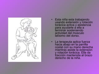 • Esta niña esta trabajando
usando extensión y rotación
torácica activa y asistencia
para ayudarle a ella a
terminar sosteniendo
actividad del músculo
latísimo del dorso.
• La terapeuta aplica fuerza
hacia abajo en la parrilla
costal con su mano derecha
mientras asiste la extensión
y rotación torácica. Ella da
tracción mantenida al brazo
derecho de la niña.
 