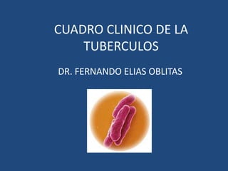 CUADRO CLINICO DE LA
TUBERCULOS
DR. FERNANDO ELIAS OBLITAS
 