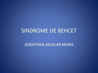 SINDROME DE BEHCET
JONATHAN AGUILAR MORA
 