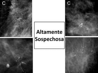 Altamente
Sospechosa
 