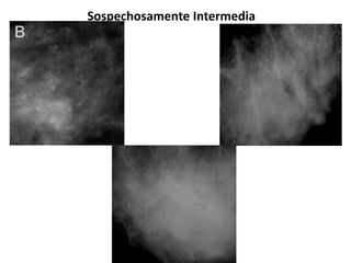 Sospechosamente Intermedia
 