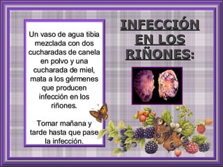 Un vaso de agua tibia mezclada con dos cucharadas de canela en polvo y una cucharada de miel, mata a los gérmenes que producen infección en los riñones. Tomar mañana y tarde hasta que pase la infección. INFECCIÓN EN LOS RIÑONES : 