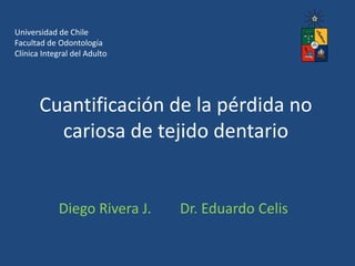 Cuantificación de la pérdida no
cariosa de tejido dentario
Diego Rivera J. Dr. Eduardo Celis
Universidad de Chile
Facultad de Odontología
Clínica Integral del Adulto
 