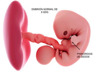 EMBRIÓN NORMAL DE
6 SDG
PRIMORDIOS
DE DEDOS
 