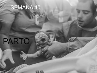 SEMANA 40
PARTO
 