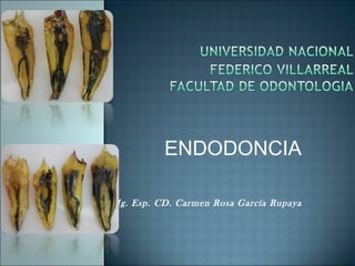ENDODONCIA Mg. Esp. CD. Carmen Rosa García Rupaya 