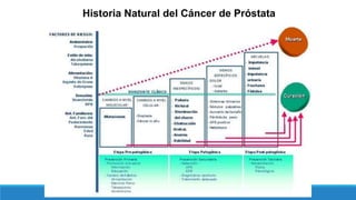 Historia Natural del Cáncer de Próstata
 