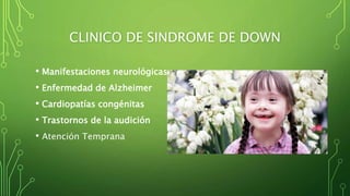 CLINICO DE SINDROME DE DOWN
• Manifestaciones neurológicas
• Enfermedad de Alzheimer
• Cardiopatías congénitas
• Trastornos de la audición
• Atención Temprana
 