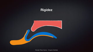 Nicolás Pérez Quiroz - Cirujano Dentista
Rigidez
 