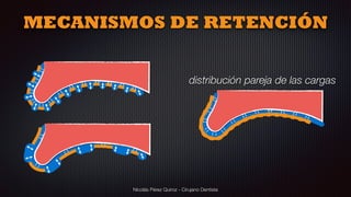 Nicolás Pérez Quiroz - Cirujano Dentista
distribución pareja de las cargas
MECANISMOS DE RETENCIÓN
 