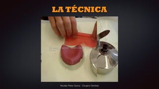 Nicolás Pérez Quiroz - Cirujano Dentista
LA TÉCNICA
 
