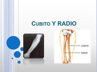 CUBITO Y RADIO

 