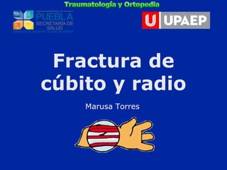 Fractura de 
cúbito y radio 
Marusa Torres 
 