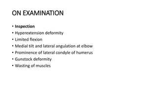 ON EXAMINATION
• Inspection
• Hyperextension deformity
• Limited flexion
• Medial tilt and lateral angulation at elbow
• Prominence of lateral condyle of humerus
• Gunstock deformity
• Wasting of muscles
 