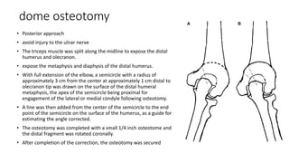 dome osteotomy
• Posterior approach
• avoid injury to the ulnar nerve
• The triceps muscle was split along the midline to expose the distal
humerus and olecranon.
• expose the metaphysis and diaphysis of the distal humerus.
• With full extension of the elbow, a semicircle with a radius of
approximately 3 cm from the center at approximately 1 cm distal to
olecranon tip was drawn on the surface of the distal humeral
metaphysis, the apex of the semicircle being proximal for
engagement of the lateral or medial condyle following osteotomy.
• A line was then added from the center of the semicircle to the end
point of the semicircle on the surface of the humerus, as a guide for
estimating the angle corrected.
• The osteotomy was completed with a small 1/4 inch osteotome and
the distal fragment was rotated coronally.
• After completion of the correction, the osteotomy was secured
 