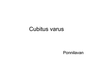 Cubitus varus
Ponnilavan
 