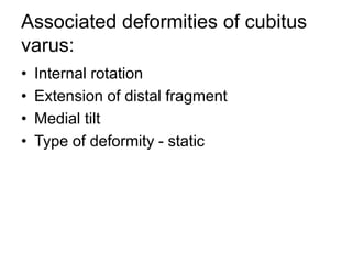 Associated deformities of cubitus
varus:
• Internal rotation
• Extension of distal fragment
• Medial tilt
• Type of deformity - static
 