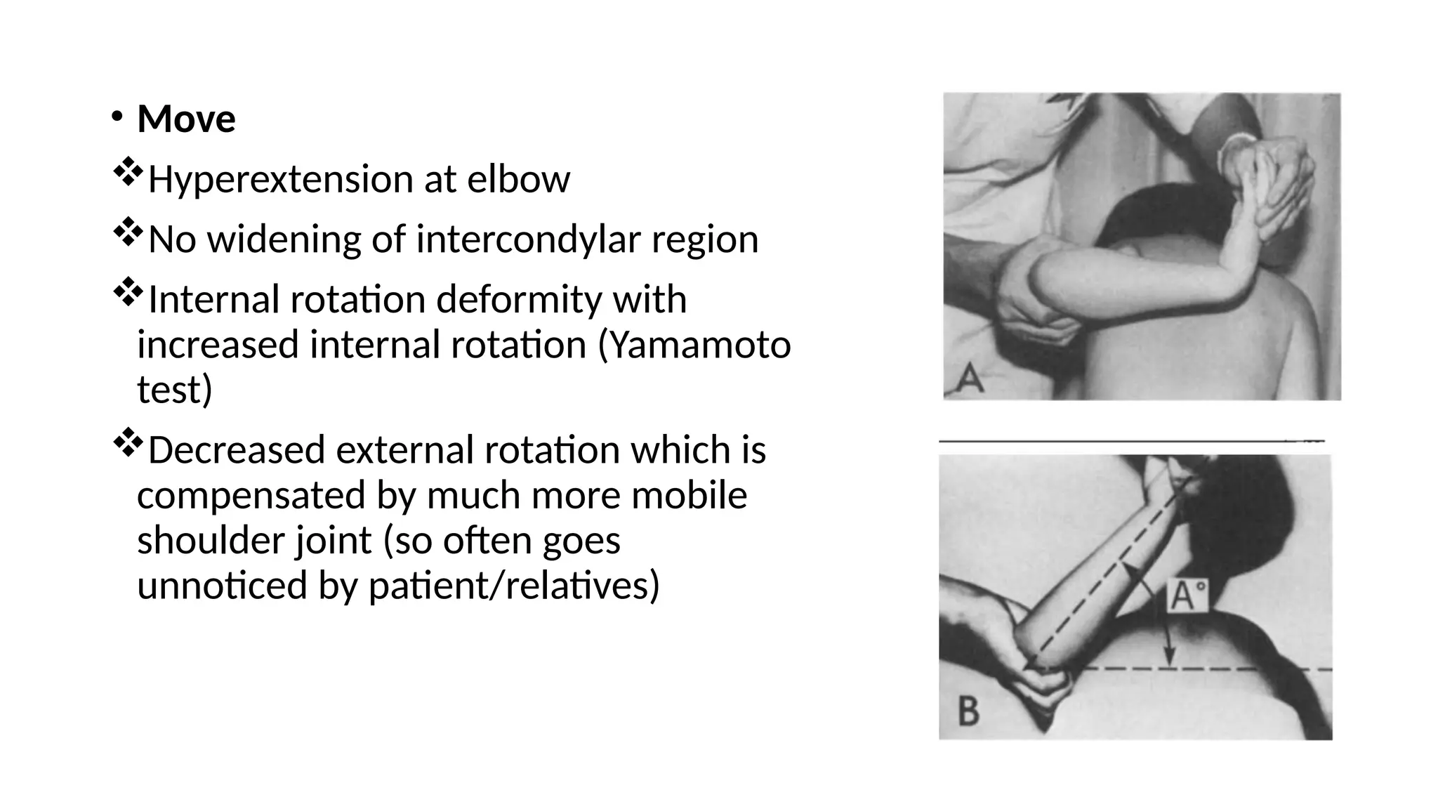 CUBITUS VARUS AND VALGUS DEFORMITY .pptx