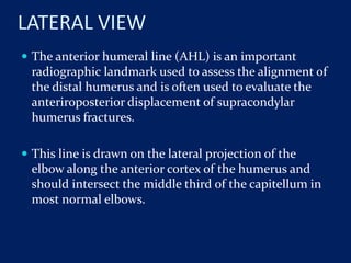 LATERAL VIEW
 The anterior humeral line (AHL) is an important
radiographic landmark used to assess the alignment of
the distal humerus and is often used to evaluate the
anteriroposterior displacement of supracondylar
humerus fractures.
 This line is drawn on the lateral projection of the
elbow along the anterior cortex of the humerus and
should intersect the middle third of the capitellum in
most normal elbows.
 