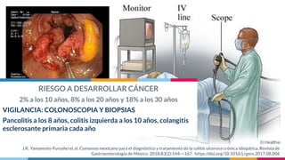 RIESGO A DESARROLLAR CÁNCER
2% a los 10 años, 8% a los 20 años y 18% a los 30 años
VIGILANCIA: COLONOSCOPIA Y BIOPSIAS
Pancolitis a los 8 años, colitis izquierda a los 10 años, colangitis
esclerosante primaria cada año
J.K. Yamamoto-Furusho et al. Consenso mexicano para el diagnóstico y tratamiento de la colitis ulcerosa crónica idiopática. Revista de
Gastroenterología de México. 2018;83(2):144---167. https://doi.org/10.1016/j.rgmx.2017.08.006
 