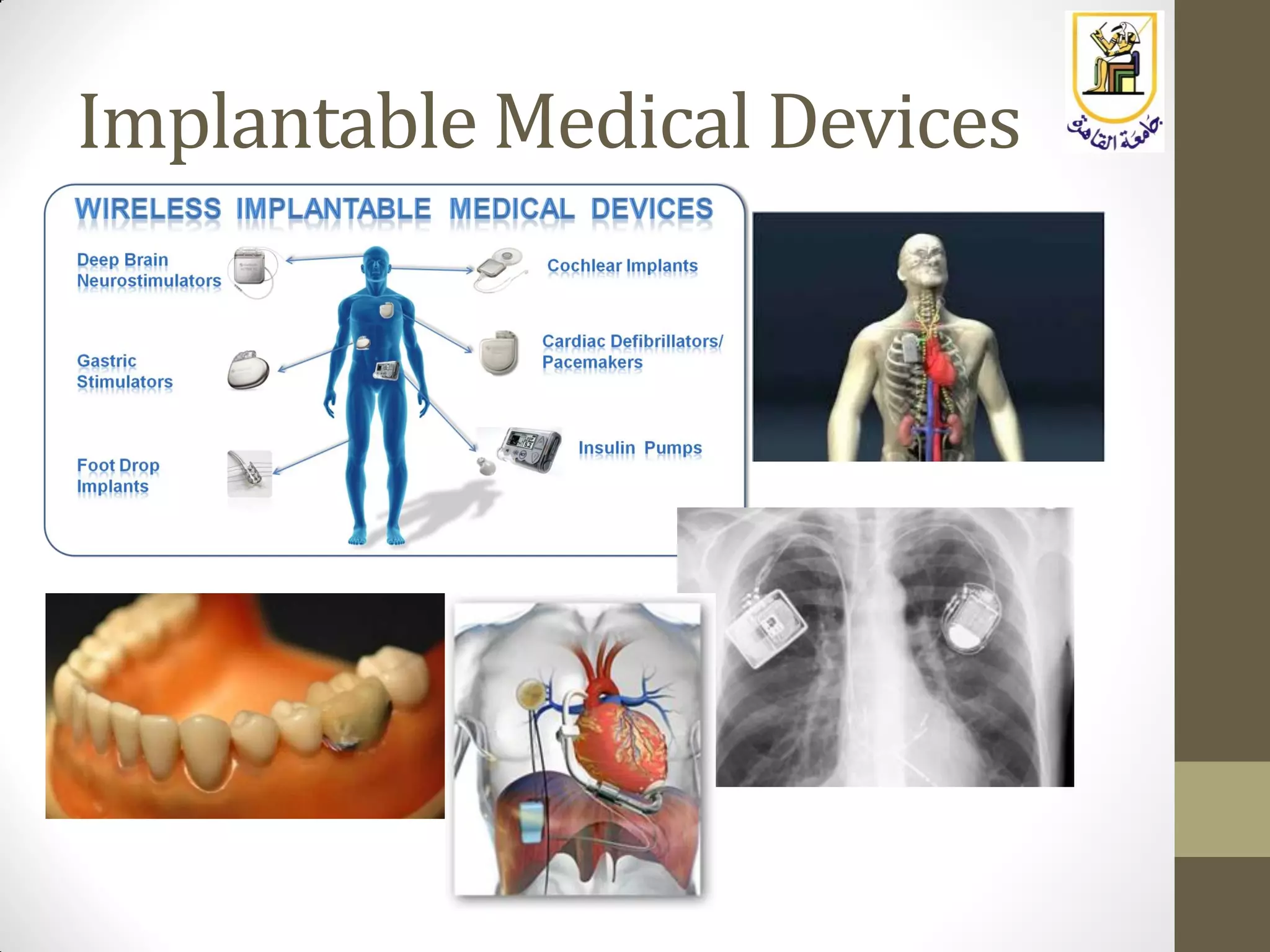 Implantable Medical Devices
 