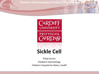 Common Haematological Problems in Childhood
Philip Connor
Paediatric Haematology
Children’s Hospital for Wales, Cardiff
Sickle Cell
 