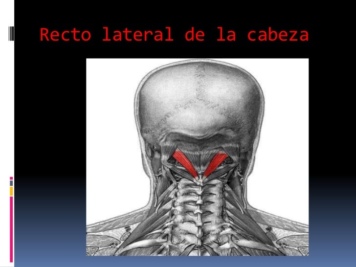 Cuello
