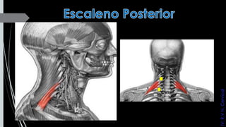 CIV
CVI
IV:R.VN.Cervical
 