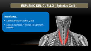 ESPLENIO DEL CUELLO ( Splenius Colli )
Inserciones :
 Apófisis transversa atlas y axis
 Apófisis espinosas 7ª cervical 4 ó 5 primeras
dorsales
 