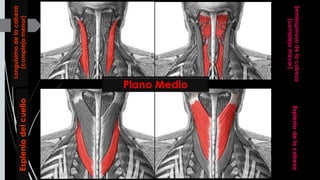Longuísimodelacabeza
(complejomenor)
Semiespinosodelacabeza
(complejomayor)
Espleniodelcuello
Espleniodelacabeza
Plano Medio
 