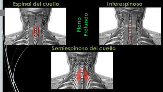 Semiespinoso del cuello
InterespinosoEspinal del cuello
Plano
Profundo
 