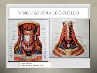 Figura 1: Cuello
Fuente: Alejandro Guerrero, 2013