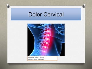 Dolor Cervical
Figura 6: Dolor Cervical
Fuente: Mejor con salud